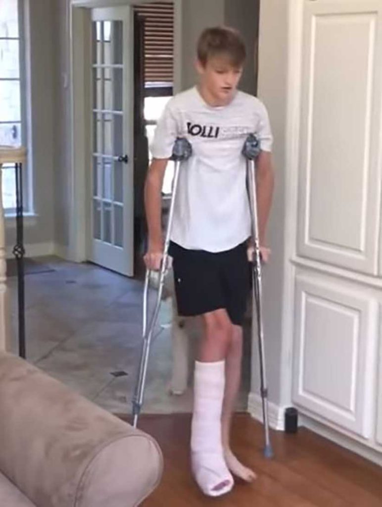dog mocks broken leg teenager